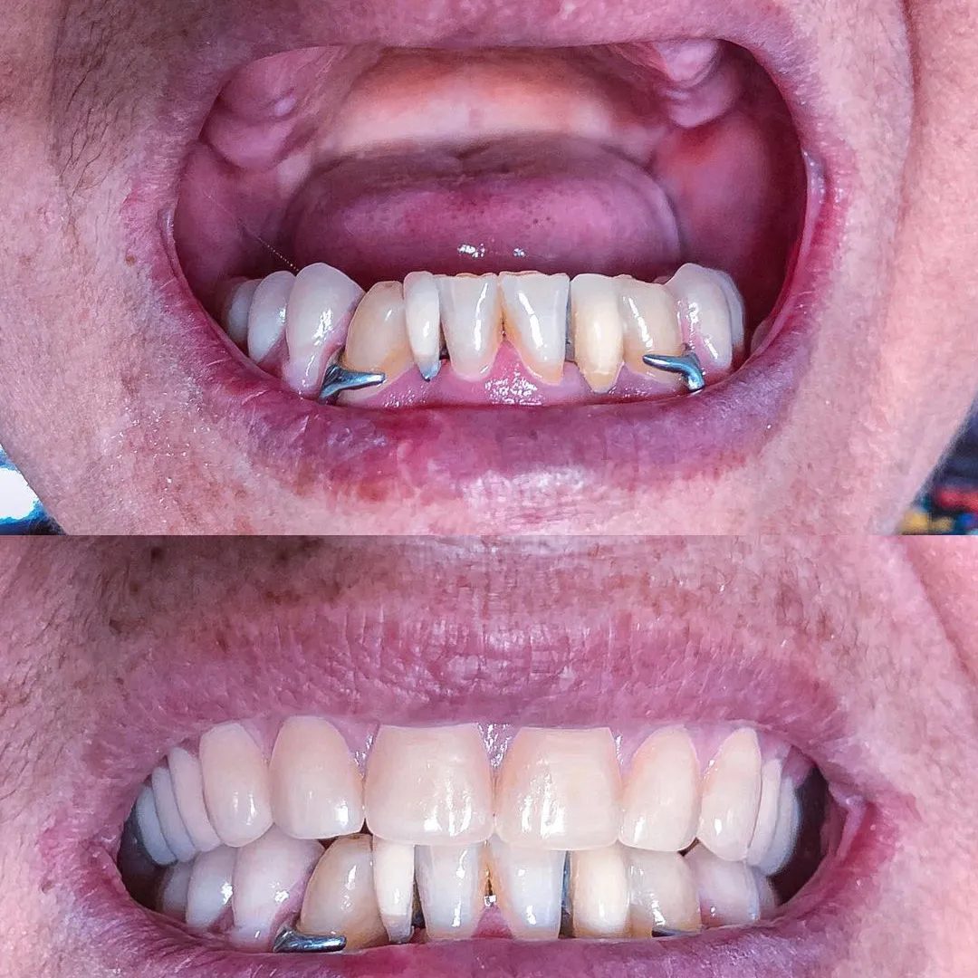 case1